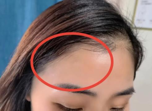 發際線怎么修 發際線怎么修