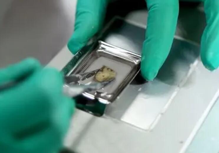 免疫組化檢查是什么意思?